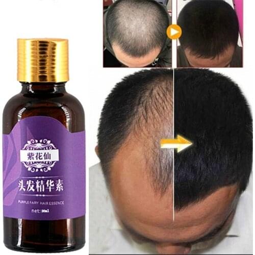 OLOEY Hair Growth Oils