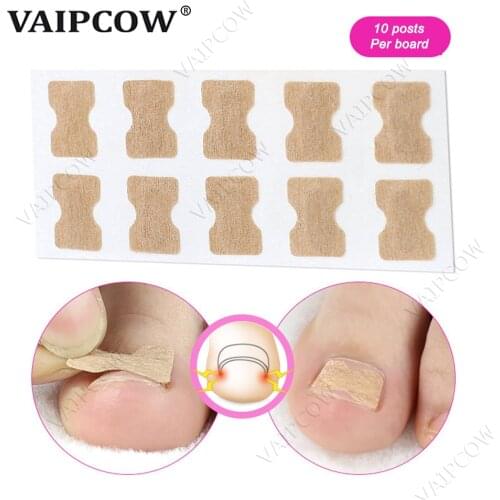 10pcs Ingrown Toenail Corrector Sticker Paronychia Treatment Fixer Recover Corrector Pedicure Foot Toe Nail Care Tool Glue Free