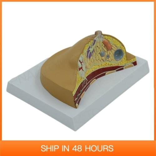 Female Breast Anatomical Model Diseased Chest Anatomy Medical Supplies and Equipment Humanbody Teaching Resources