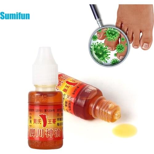 1Pc Foot Odor Treatment oil Anti bacterial Anti-itch Chinese Medical Ointment Cure Beriberi Foot Sweat Itching Cream Foot Care