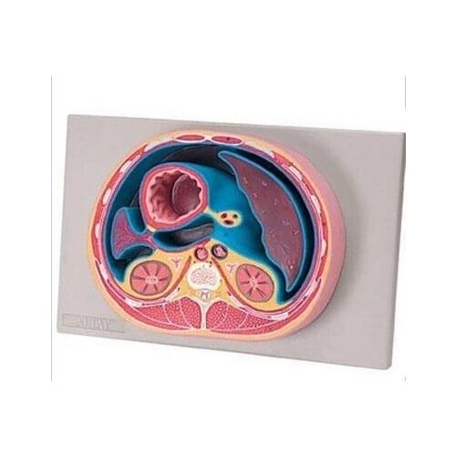 Human Anatomical Cross Sectional Model of Abdominal Cavity Anatomy Peritoneal Transection Model Simulator Nurse Training Kit
