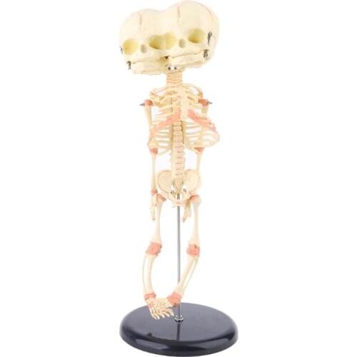 Human Baby Deformed Head Skull Research Model Skeleton Anatomical Brain Anatomy Teaching Study Display