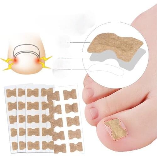 10 Pcs Nail Correction Patch Toenail Paronychia Ingrown Nail Corrector Toenail Patch Manicure Toenail Repair Correction Reset