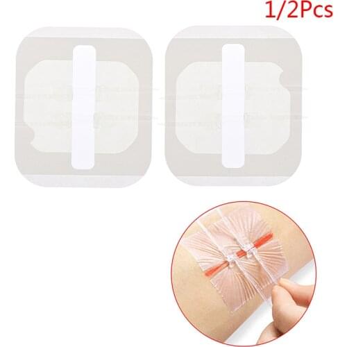 1/2PCS Zip Suture Reducer Band Aid Zippered Wound Painless Suture Adhesive Wound Closure Band Aid Painless Wound Closure Device