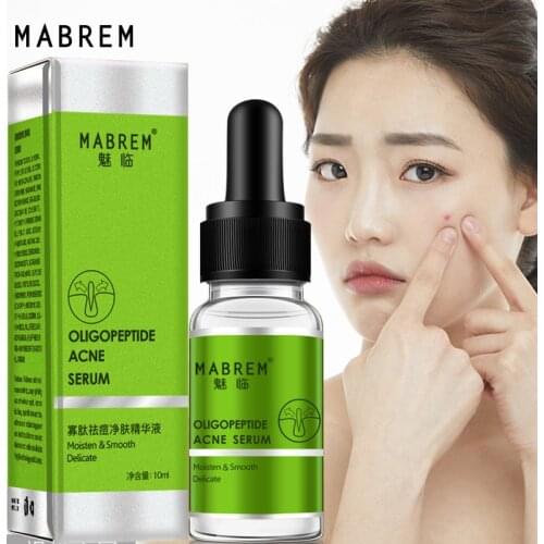Oligopeptide Acne Cleaning Lotion Serum Acne Treatment Cream Pore Repair Whitening Anti Anging Winkles Essence Moisturizing 10ML