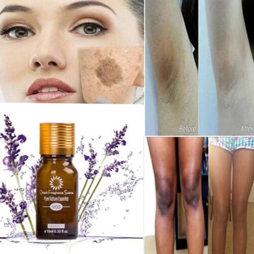 30ML Lightening Whitening Plant Essential Oil White Oil-free Face Body Skin Care Natural Purity Massage Oil