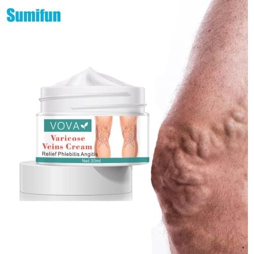 1pc 30ml Varicose Veins Ointmnet Vasculitis Phlebitis Spider Cream Varicosity Angiitis Removal Herbal Medical Plaster