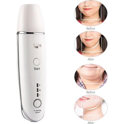 Mini Hifu Line V-shape Ultrasonic RF Face Liting Wrinkle Removal Anti-Aging Skin Revive Collagen Tighten Skin Care Beauty Device