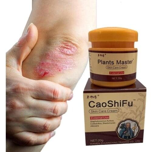 1pc 20g Plant Skin Cream Skin Psoriasis Cream Dermatitis Eczematoid Eczema Ointment Ringworm Cream