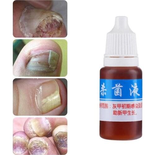 10ml Health Skin Care Nail Repair Liquid Cleanser Onychomycosis Remover L7X5