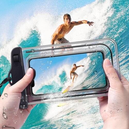 Shellbox Phone Cases Xiaomi Mi 5S Plus