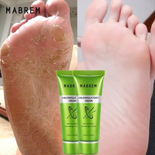 2pcsMABREM Foot Treatment Cream Whitening Anti-cracking Moisturizing Protection Cream Relive Pain Foot Cream Exfoliating Scrub