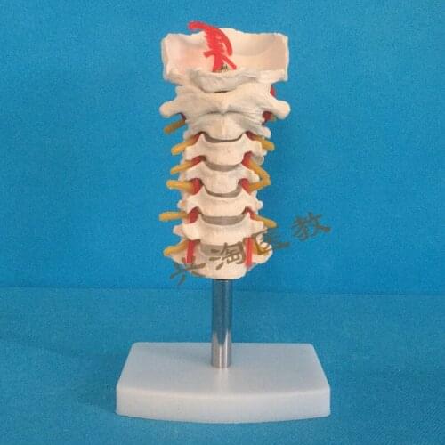 Cervical skeleton model with carotid artery posterior occipital bone intervertebral disc and nerve