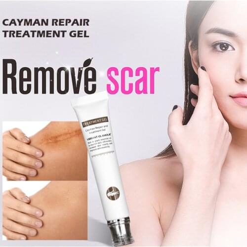 Crocodile Repair Scar cream Removal Acne Scars Stretch Marks CreamSurgical scar Burn For Body Pigmentation Corrector TSLM2