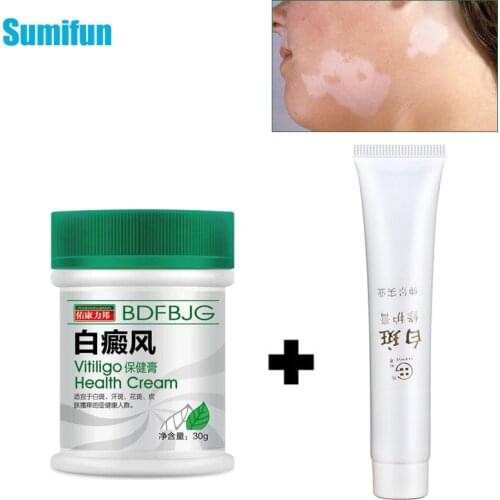 2 Types White Spot Disease Cream Pigment Melanin Promoting Liniment Skin Vitiligo Leukoplakia Disease Chinese Medical Treatment