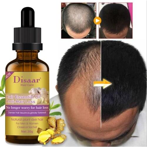 Ginger Hair Growth Essence Nourishes Hair Roots Repair Damaged Hair Loss Treatment Rapid Growth Hair Essence For Men Women