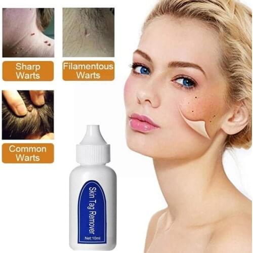 Wart Removal Beauty Liquid Genital Wart Treatment Papillomas of Warts Removing Skin Liquid Tags Removal From D2F0