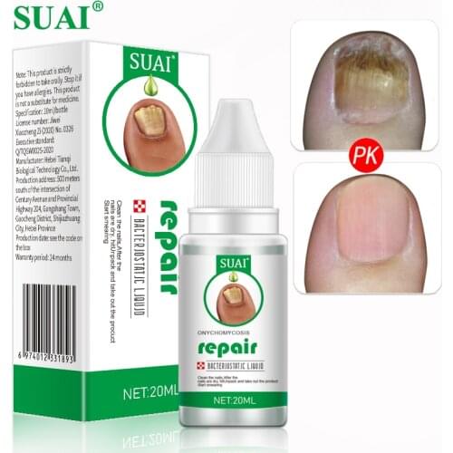 SUAI 20ML Fungal Nail Treatment Serum Onychomycosis Paronychia Anti-Fungal Nail Infection Herbal Toe Fungus Foot Repair Essence