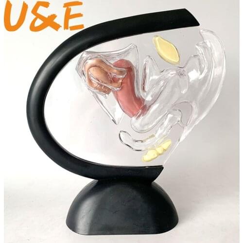 Female reproductive system model Transparent uterus model Female anatomical model