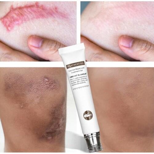 Treatment Gel Repair Scar Cream Removal Scars For Face Or Body Pigmentation Corrector Scalded Surgery Scar Insect Bites Mark