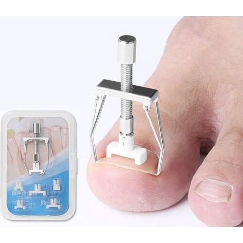 1 set Straightening Clip Brace Corrector Wire Fixer Ingrown Toenail Toe Fixer Recover Correction Device Pedicure Foot Nail Care