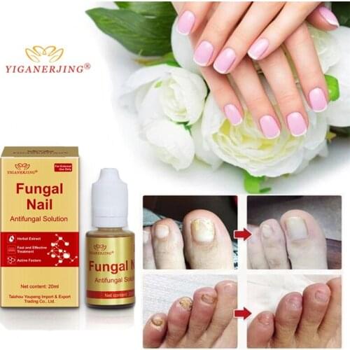Fungal Nail Treatment Feet Care Essence Nail Foot Whitening Toe Nail Fungus Removal Gel Anti Infection Paronychia Onychomycosis