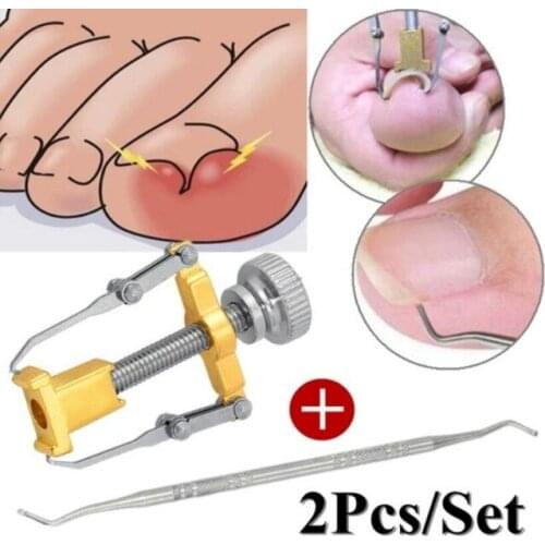 Straightening Clip Ingrown Toenail Corrector Pedicure Foot Nail Care Tools Stainless Steel Pedicure Treatment Onyxis Correction