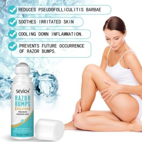 Sevich 90ml Unisex Ingrown Hair Treatment Mild Serum Reduce Skin Redness Smooth&Repair Skin After Shaving Razor Burns Roll