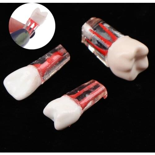 1pcs Dentist Tools Resin Dental Endodontic Tooth Model With Colored Root Canal And Pulp Model For Student Study Practice