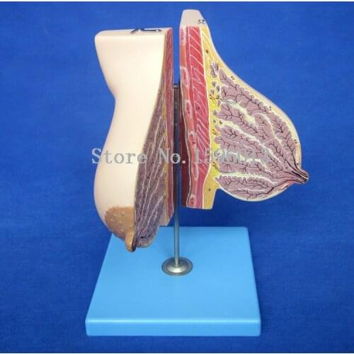 Mammary Gland in Lactation Model, Anatomical Section Model of Female Breast