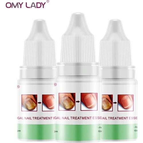 OMY LADY 3pcs Fungal Nail Treatment Essence and Foot Whitening Toe Fungus Removal Gel Anti Infection Paronychia Onychomycosis