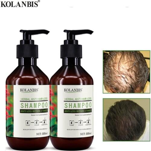 2 bottle Ginseng Shampoo Stop Hair Fall Hair Loss Product Weak Falling Out Hair Thick Fast Growth