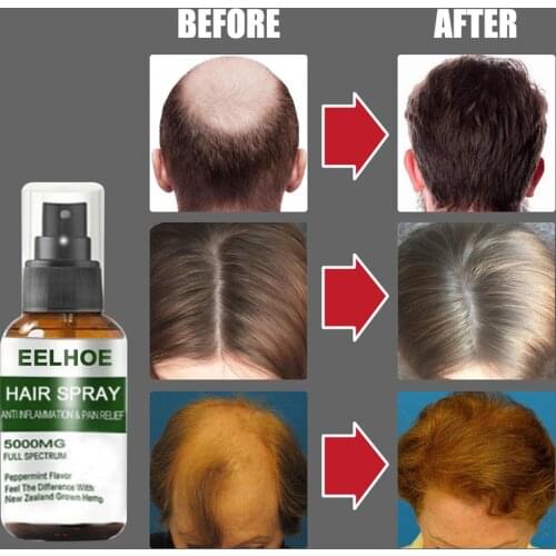 New 30ml Hair Growth Serum Hair Care Hair Serum Fast Hair Growth Hair Spray Anti Hair Loss Natural Herbal Essence