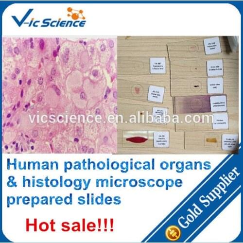 Human pathological organs and histology prepared slides,pathological organs slides,human organs slides