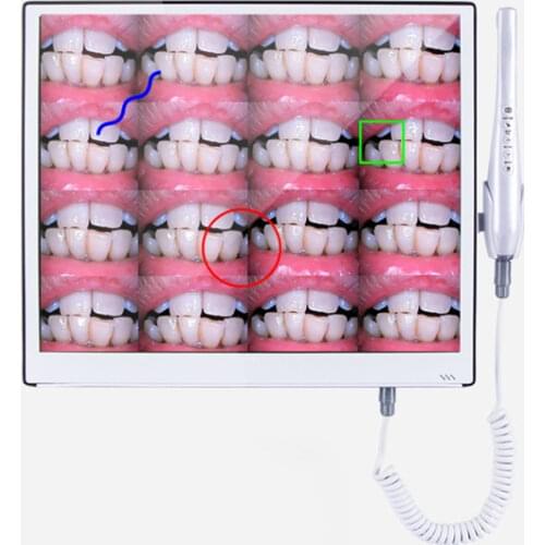 NSK S MAX SG20 Dental implant 20:1 Low Speed Contra Angle Handpiece