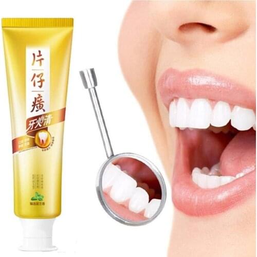 Toothpaste Bleeding Gums Dental Pain Relieving Cream Relieve Swelling Bleeding Oral Inflammation 145g Flavour Toothpaste