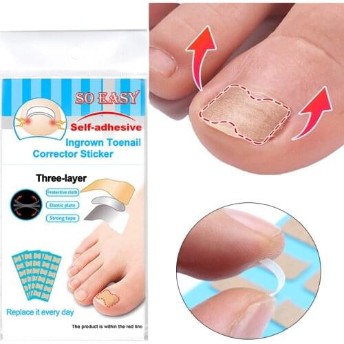 36/48/60pcs Nail Correction Sticker Toenail Ingrown Paronychia Pedicure Tool Toe Inlay Corrector Elastic Professional Nail Patch
