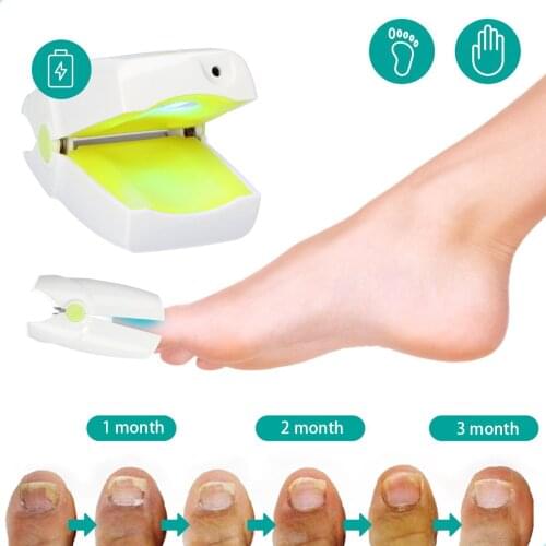 Nail Fungal Treatment Cold Laser Therapy Nail Foot Whitening Toe Nail Fungus Removal Gel Anti Infection Paronychia Onychomycosis