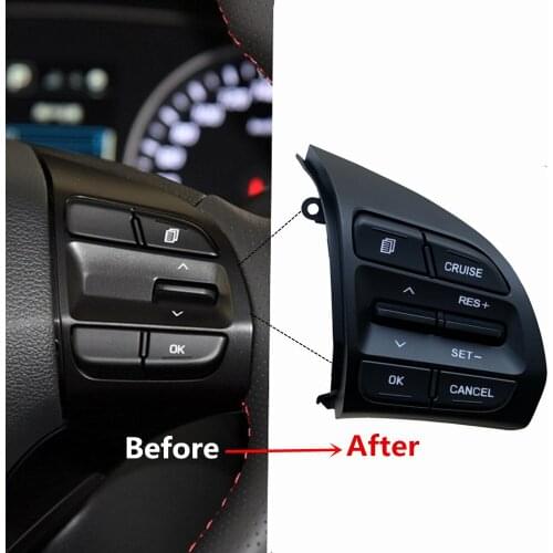 Multi Functional Steering Wheel Modification Button For Hyundai Elantra 1.4T Steering Wheel Button