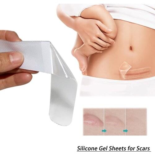 12*3.5cm Efficient Caesarean Section Surgery Silicone Gel Removal Scar Sheet Therapy Patch For Acne Trauma Burn Scar Skin Repair