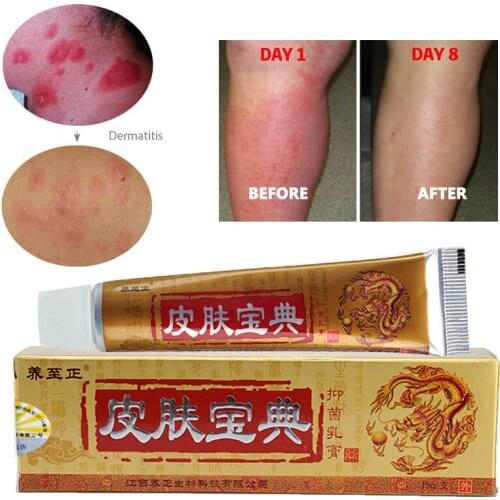 1PCS YIGANERJING Pifubaodian Original Psoriasis Dermatitis Eczema Pruritus Skin Problems Cream Without Retail Box