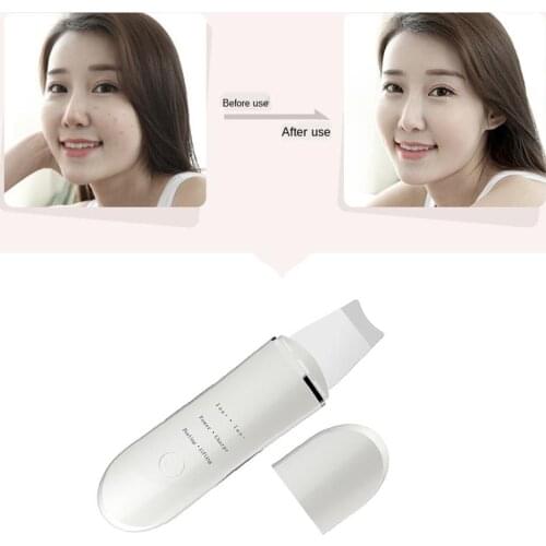 Electric Skin Scrubber Face Cleanser Blackhead Acne Removal Ultrasonic Ion Facial Lifting Anti Aging Peeling Machine Massager