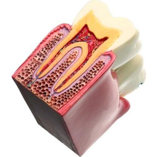 Teeth Model 6 Times Caries Comparation Study School study Models Dental Materials Lab