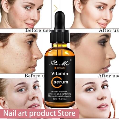 30ml Vitamin C Serum for Face, Topical Facial Serum with Hyaluronic Acid, Vitamin E, 1 fl oz