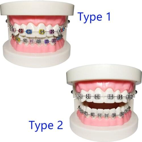1 Piece Dental Orthodontic Teeth Model Metal Brackets with Ligature Tie Buccal Tube NiTi Archwire