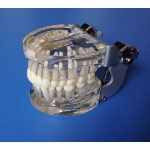 Transparent Oral Teeth Model ,Transparent Adult Standard Tooth Column Model ,Crystalline Teeth Model