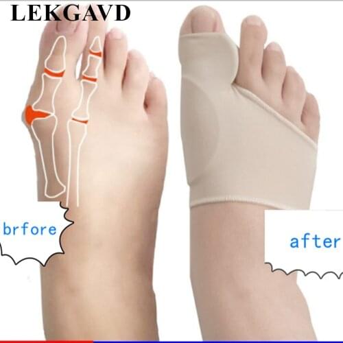 2pcs 1pair Big Toe Hallux Valgus Corrector Orthotics Feet Care Bone Thumb Adjust Correction Pedicure Straightener None Electric