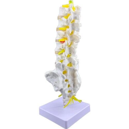 Natural size adult five-section lumbar vertebrae model human body Skeletal model Lumbar model