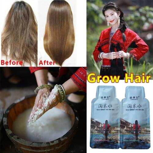 Rice Hair Growth Shampoo Anti Hair Loss Treatment Serum Fast Growth Longer thicker Hair for Men Women Best Hair Care Product
