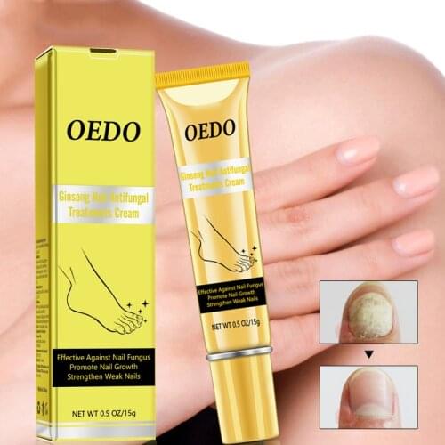 Ginseng Herbal Removal Nail Fungus Toe Nail Antifungal Treatments Cream Anti Infection Paronychia Onychomycosis Foot Care Cream